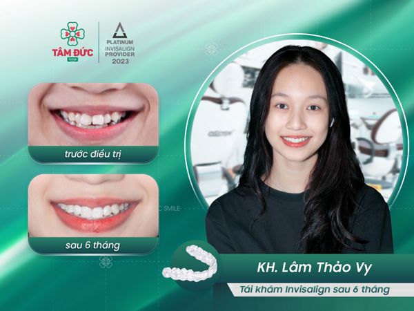 Trung tâm Nha khoa Tâm Đức Smile không ngừng học hỏi, bắt kịp và áp dụng nhiều công nghệ