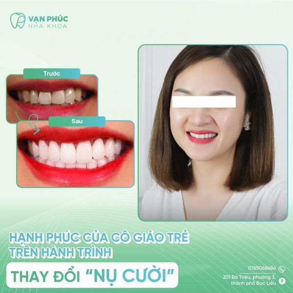 Nha Khoa Vạn Phúc nổi tiếng là phòng khám nha khoa Bạc Liêu với dịch vụ chăm sóc răng miệng chất lượng cao và hiện đại